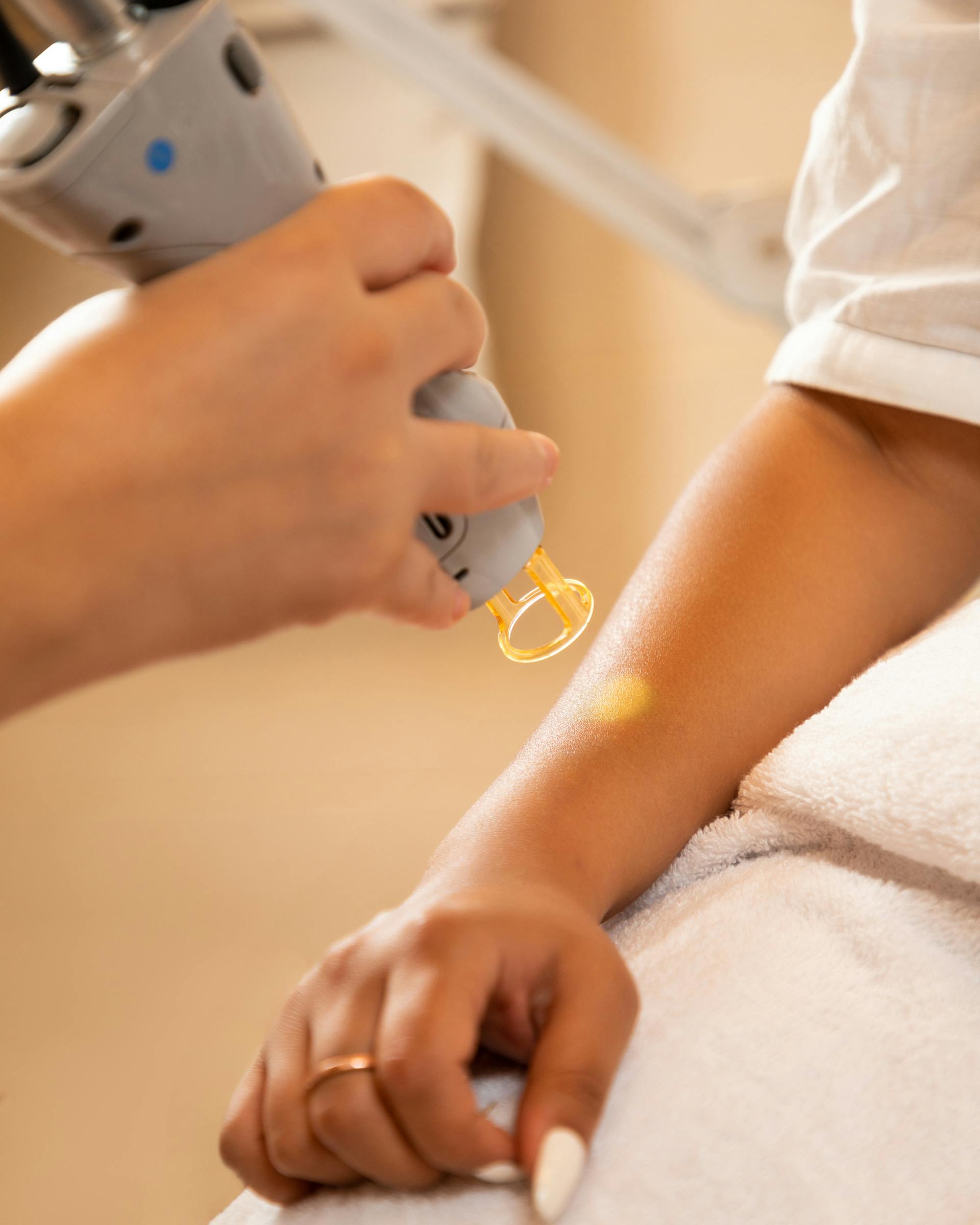 Epilation définitive laser vs lumière pulsée chez Laser Lyne à Le Soler